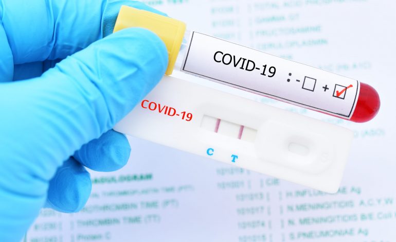 Salud Pública notifcaron 1,059 nuevos casos de COVID-19 y cinco defunciones